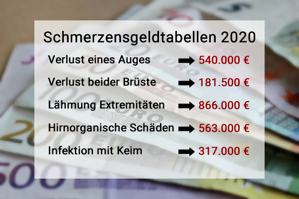 Schmerzensgeldtabelle 2020