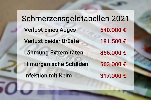 Schmerzensgeldtabellen für verschiedene Verletzungen verursacht durch Arztfehler / Behandlungsfehler bzw. Unfall